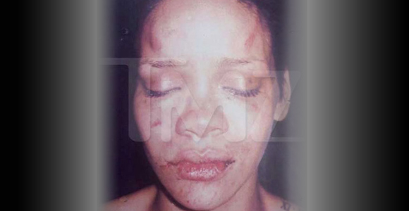 rihanna beaten by chris brown pictures. PHOTOS OF BEATEN RIHANNA